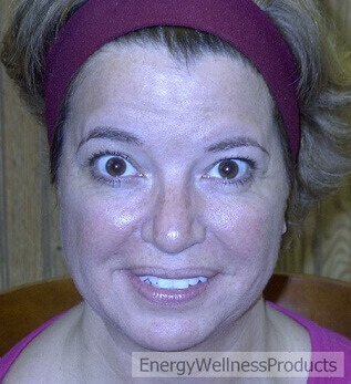 Before E-Power Facial Skin Rejuvenation