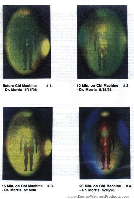 Kirlian Photography showing improved energy from the chi machine