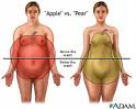 obesity