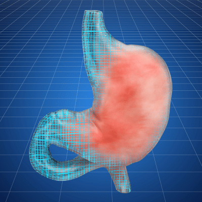 stomach acid