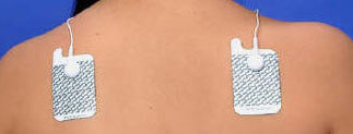 E-Stim Electrical Stimulation